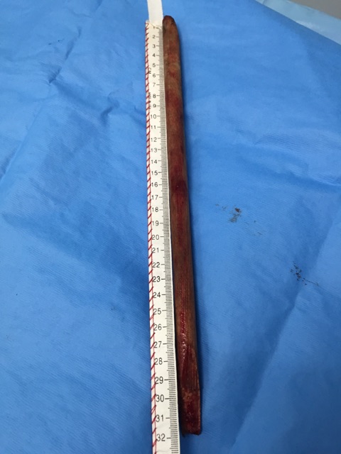 Cooper Lamb stick ruler