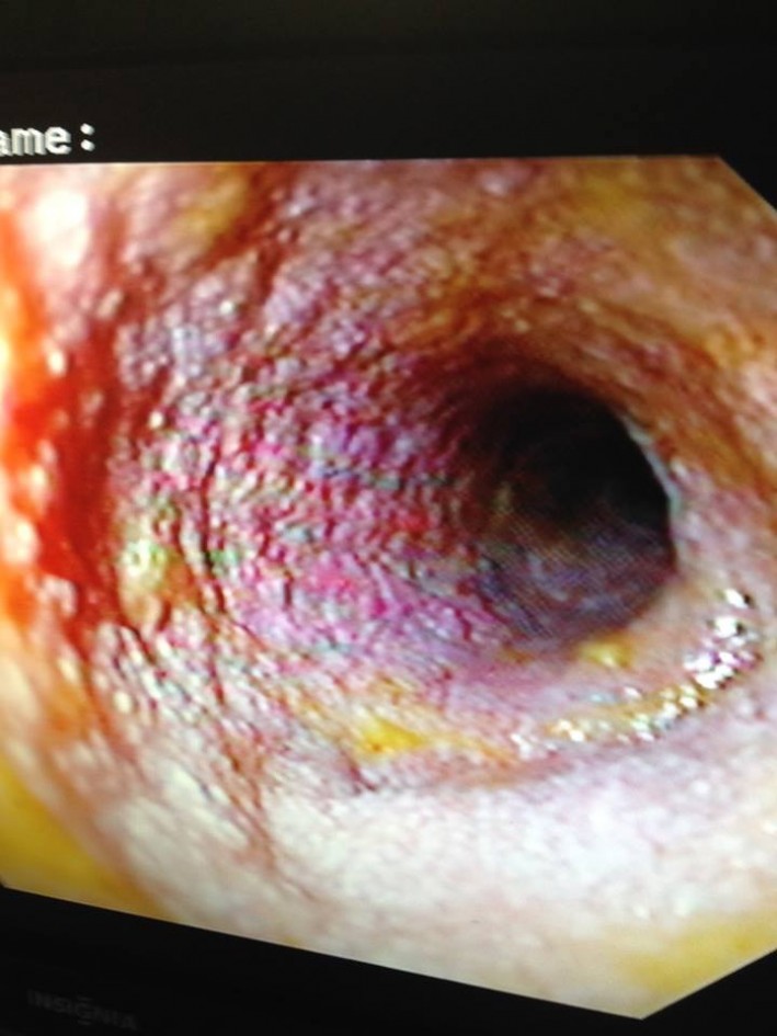 IM scope image Abby Power 1