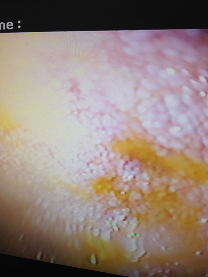 IM scope image Abby Power 2