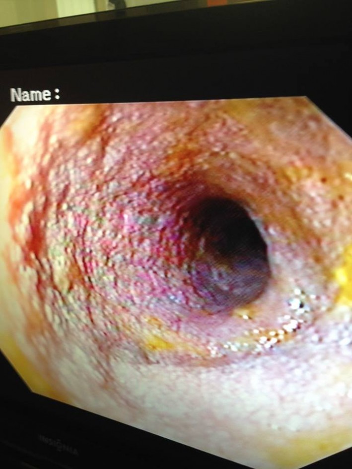 IM scope image Abby Power 3