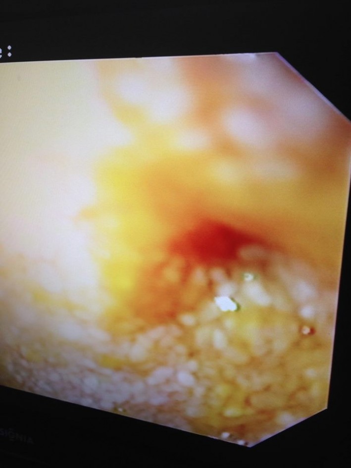 IM scope image Abby Power 4