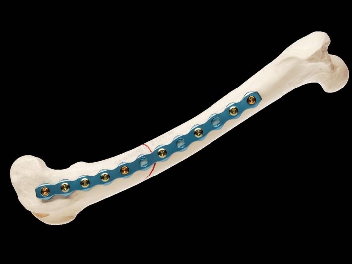 KYON Titanium Advanced Locking Plate System (ALPS) implant.  Photo courtesy of Kyon Veterinary Surgical Products.