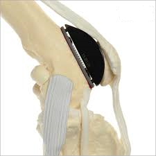 Kyon PGR implant courtesy of Kyon Veterinary Surgical Products.